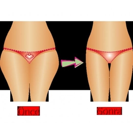 Basen Bölgesi İnceltici Hareketler